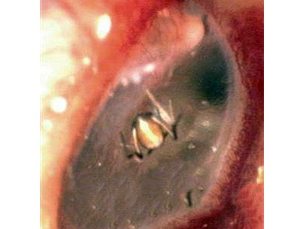 சிலந்தி