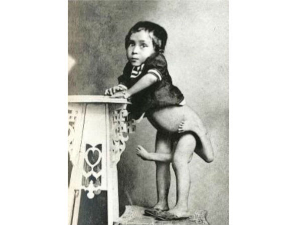 பாட்டம் ட்வின்!