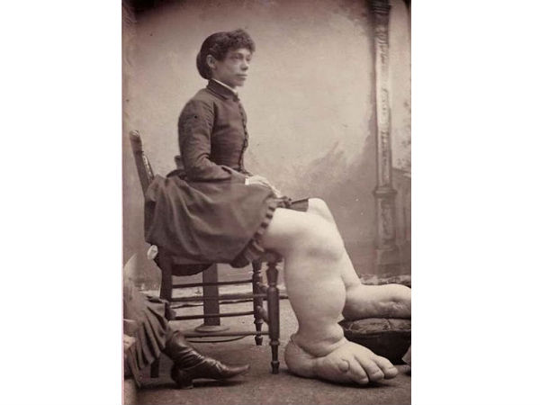 பெரிய கால்கள்!