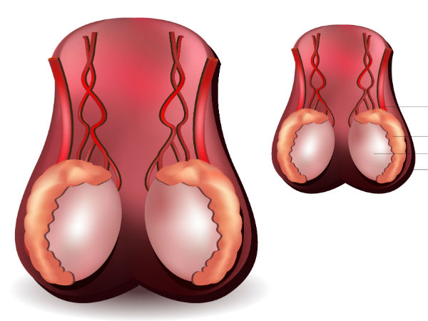 விரை வீக்கம்!