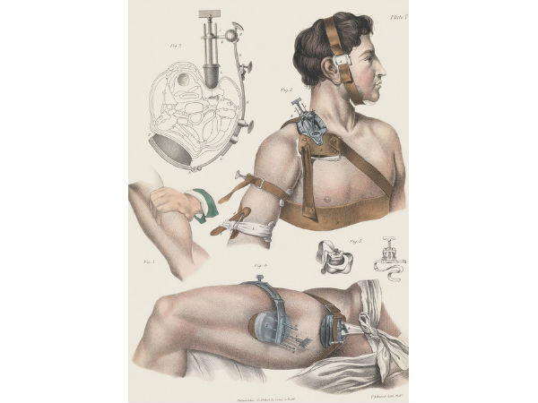 தமனி சுருக்கம்!