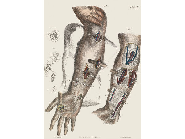 மூட்டு பகுதி!