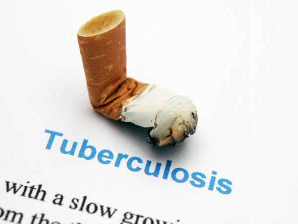 கபம் மற்றும் காச நோயாளிகளுக்கு :