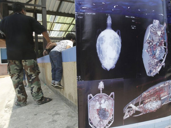 7 மணிநேர அறுவை சிகிச்சை 7 மணிநேர அறுவை சிகிச்சை