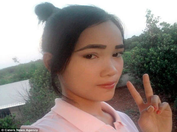 பற்களை பிரித்தெடுத்தல் பற்களை பிரித்தெடுத்தல்