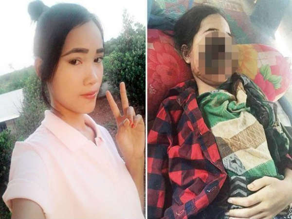 சதையை சாப்பிடும் தொற்று சதையை சாப்பிடும் தொற்று