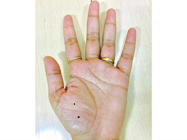 அறிகுறி #2