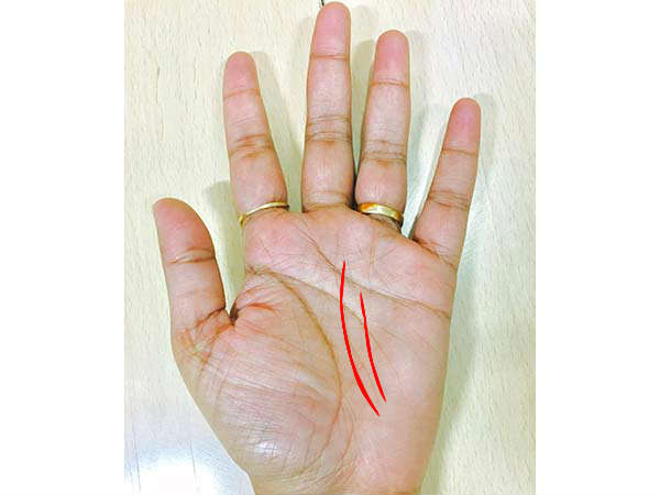 அறிகுறி #5