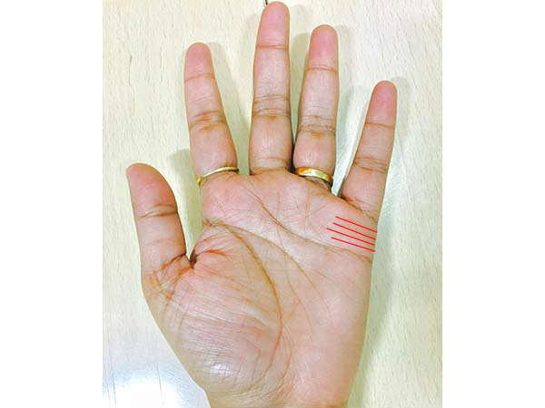 அறிகுறி #6