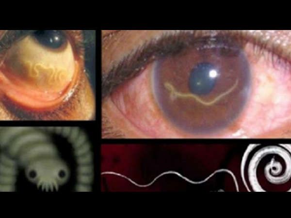 Stop Eating This Type Of Food Because Dangerous Worms May Appear Inside Your Body! Stop Eating This Type Of Food Because Dangerous Worms May Appear Inside Your Body!