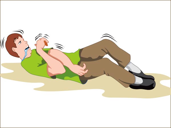 வலிப்பு வலிப்பு