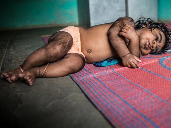 தீர்வு தான் என்ன?