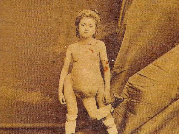 பிரான்செஸ்கோ லெண்டினி! பிரான்செஸ்கோ லெண்டினி!