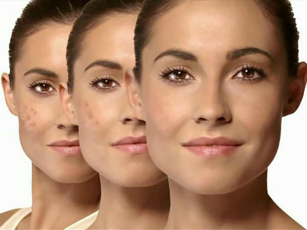 Potato Lemon Ice Cubes Remove Dark Spots In 3 Days Potato Lemon Ice Cubes Remove Dark Spots In 3 Days