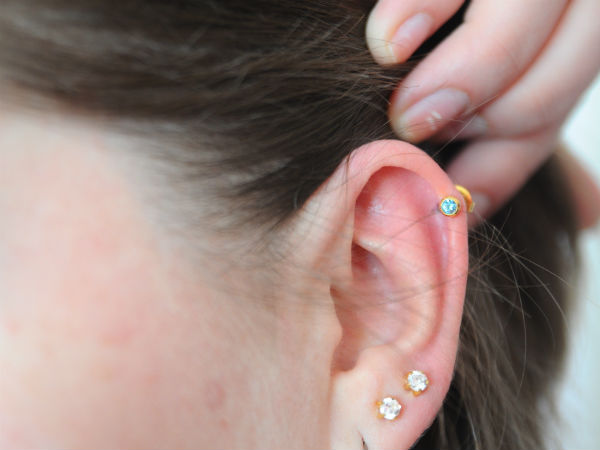 ஆரிக்கல் : 