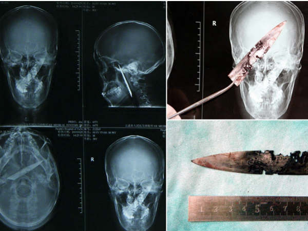 துருப்பிடித்த கத்தி : 
