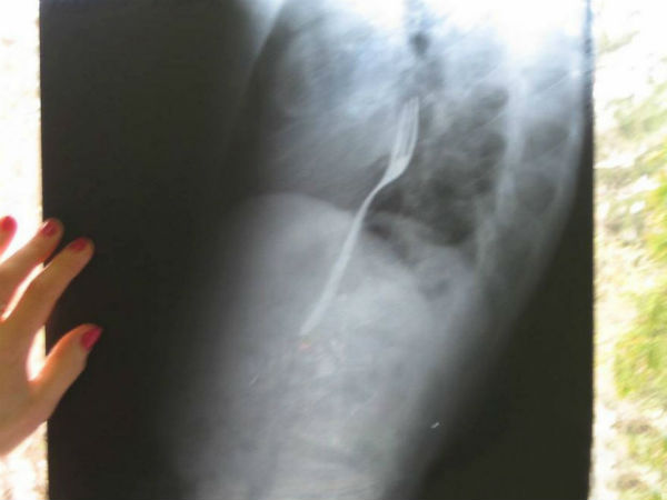 ப்ளாஸ்டிக் ஃபோர்க் : 