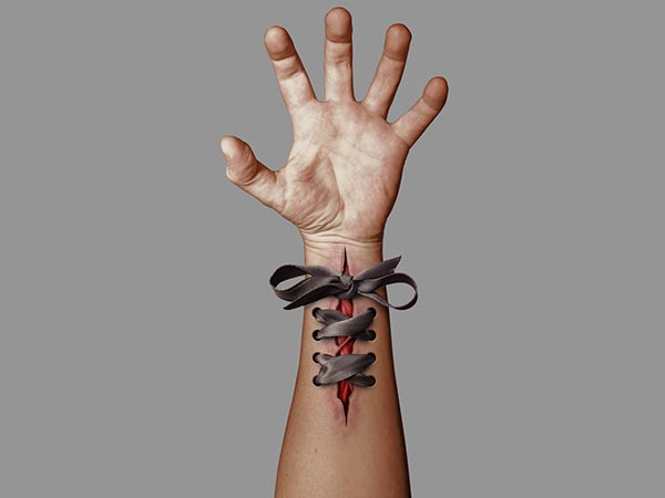 # மன நோய் / தற்கொலை