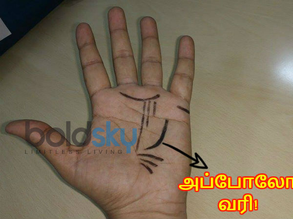 அப்போலோ வரி! அப்போலோ வரி!