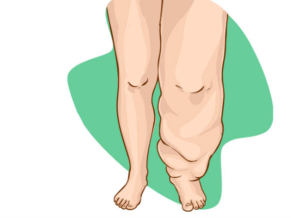 மருந்து செய்முறை: