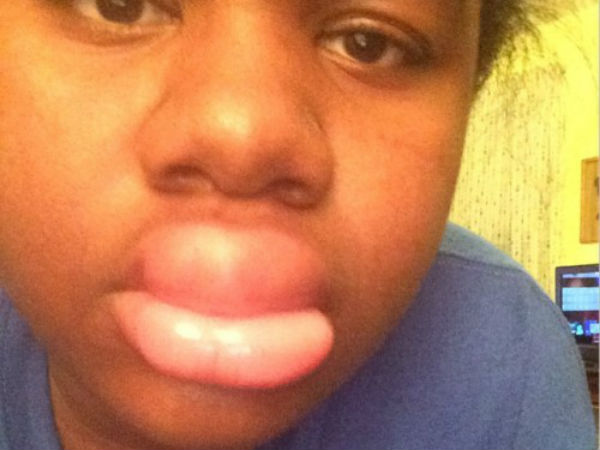 பன்றி உதடு சேலஞ்ச் : 