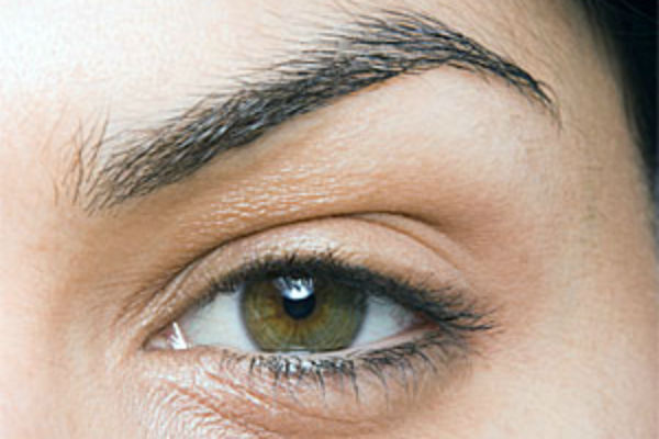 காரணம் : 