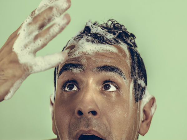 வழுக்கைத்தலை : 