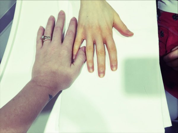 அரியவகை கோளாறு!