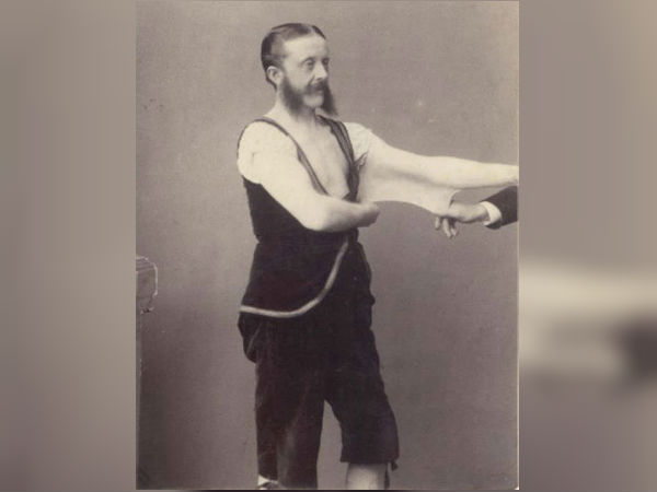 எலாஸ்டிக் மனிதன்!