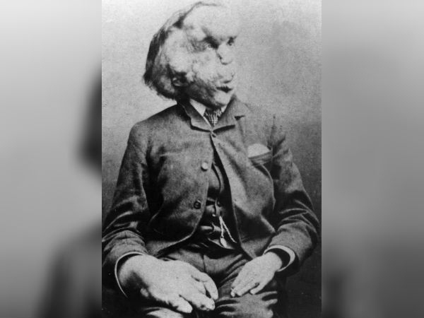 யானை மனிதன்!