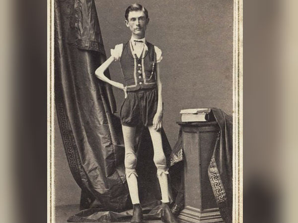 ஹியூமன் ஸ்கெலிட்டன்!