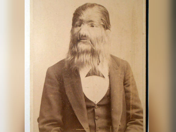 நாய் மனிதன்!