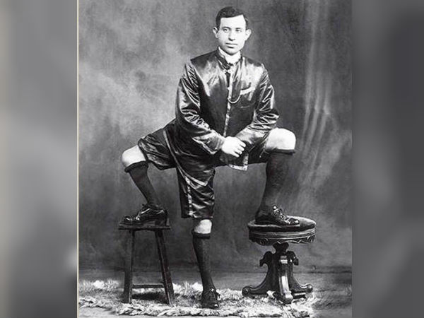 ஒட்டுண்ணி ட்வின்!