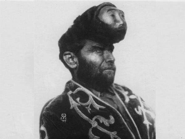 இரண்டு தலை மனிதன்!