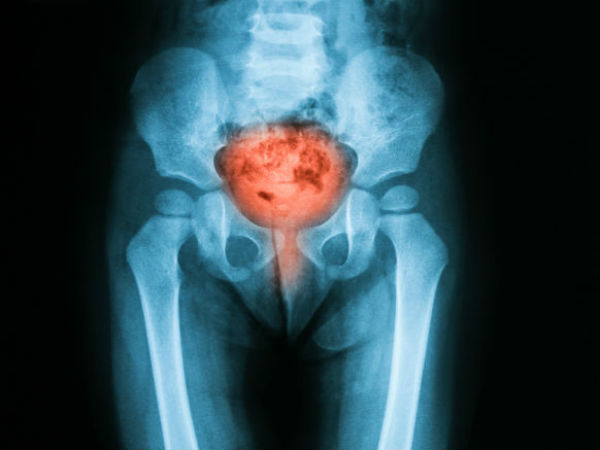 வயிற்று வலி : 