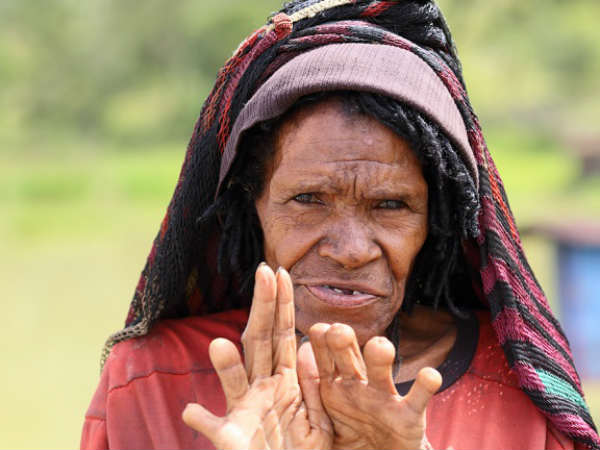 விரலை வெட்டுதல் : விரலை வெட்டுதல் :