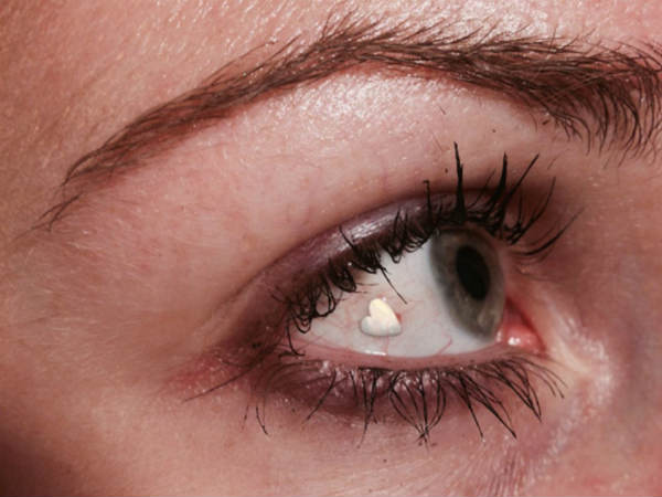 நெதர்லாந்து : 