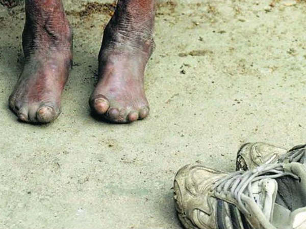 முதல் அரசியல் கைதி :