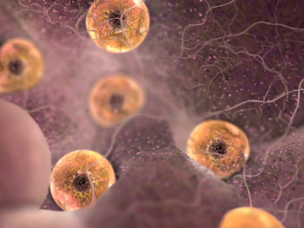 கருமுட்டை சேகரிப்பு : 