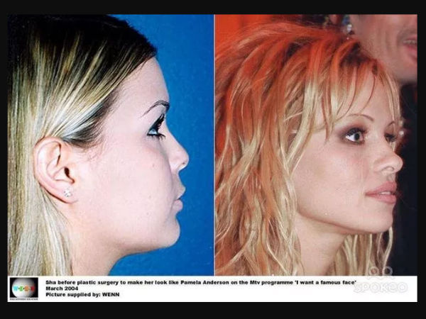 பமீலா ஆண்டர்சன்!