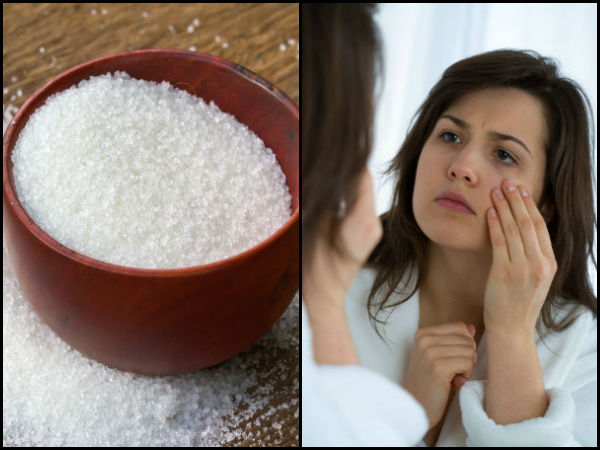 சர்க்கரை நோய் : 