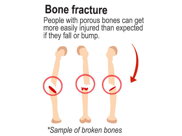 அரேபிய மருத்துவ முறை அரேபிய மருத்துவ முறை