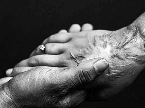 சிகிச்சை : 