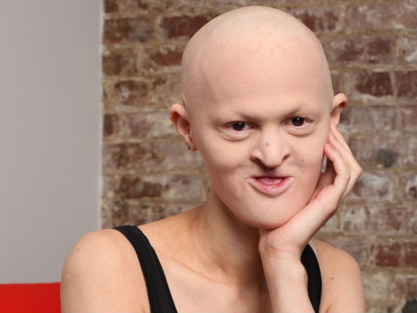 மெலைன் கேய்டோஸ் : 