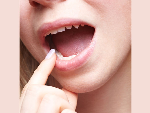 பற்கள் :