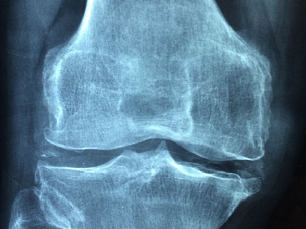 காரணம் : 