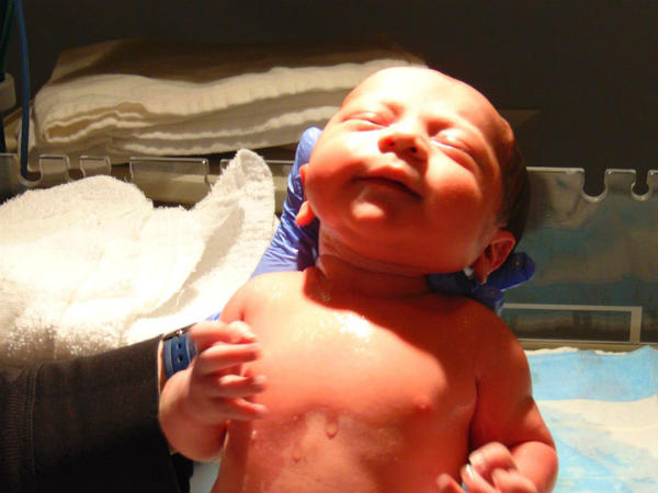 மஸ்டிடிஸ் : 