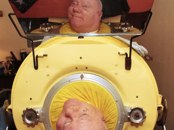 போலியோ : 