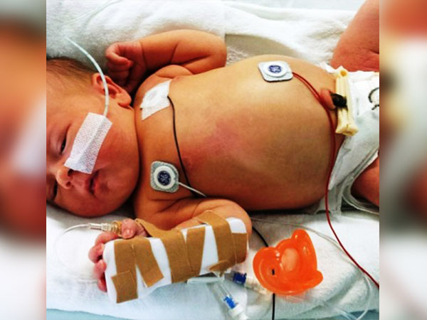 வால்மேன் நோய்