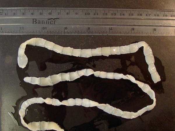 உயிருள்ள புழுக்கள் : 